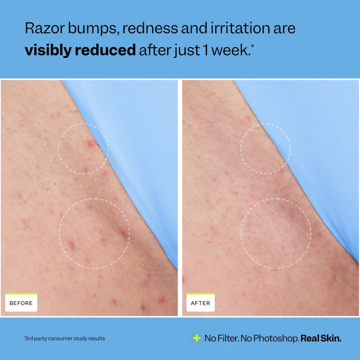 Smoothing Solution Ingrown Hair Treatment (Copy)